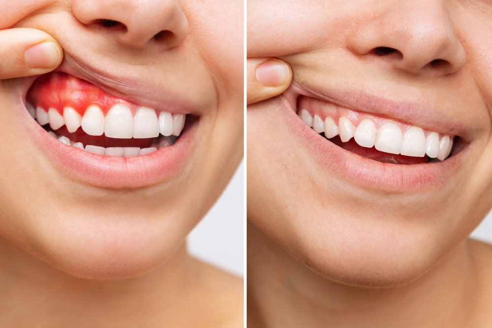 what is periodontal treatment and how does it help with gum disease